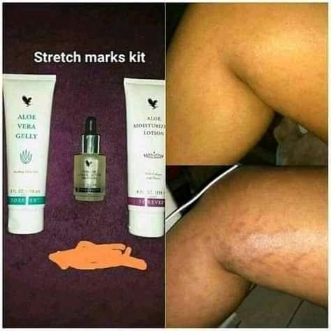 R950 combo